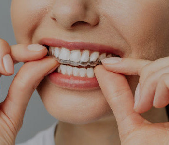 Orthodontie adulte Saint-Germain-les-Corbeil